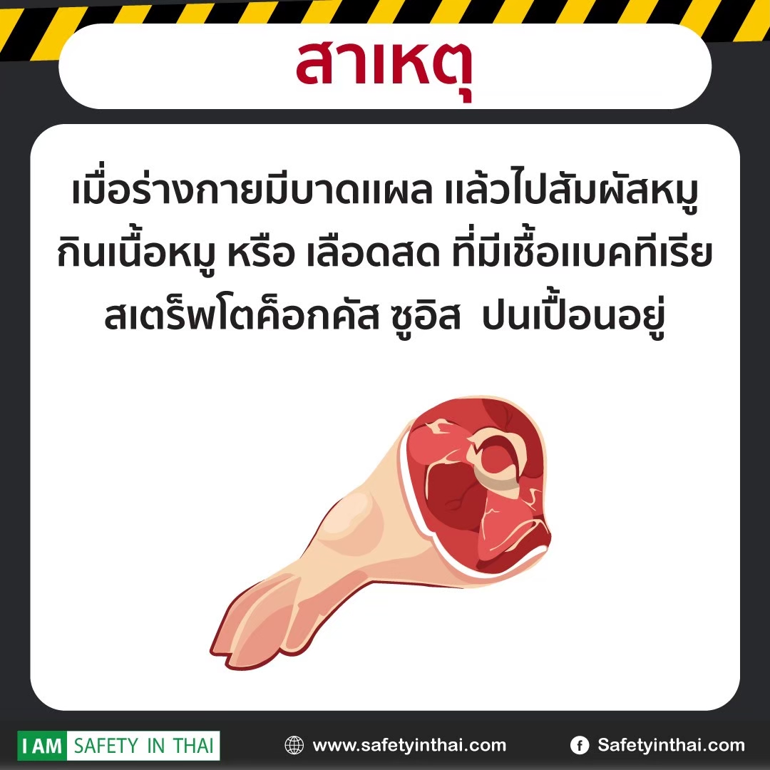 อันตรายจากกินหมูดิบ