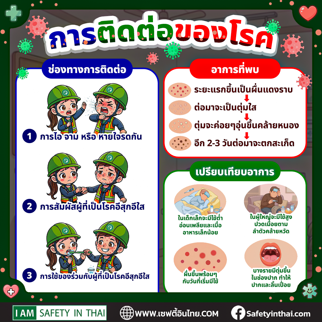 โรคอีสุกอีใส ติดกันได้ไหม