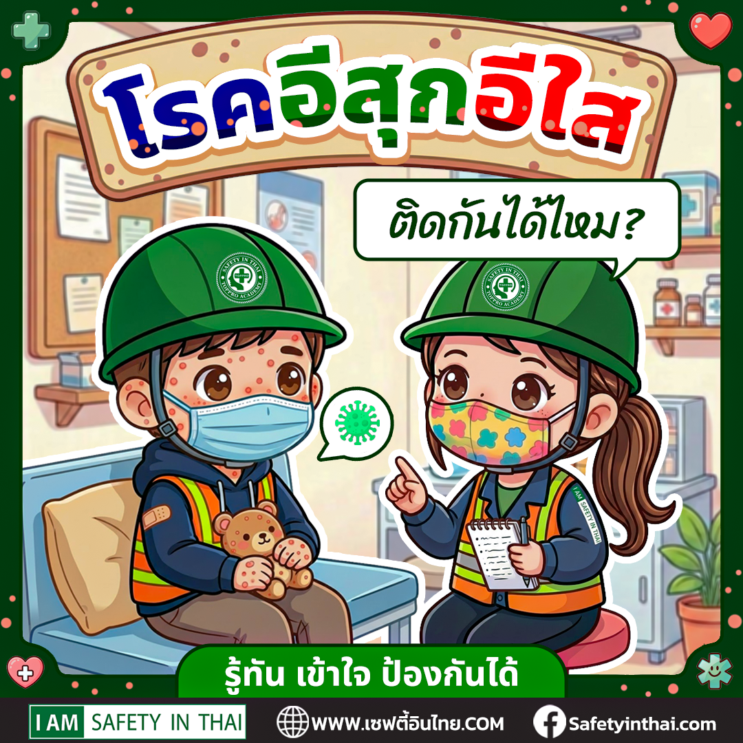 โรคอีสุกอีใส ติดกันได้ไหม