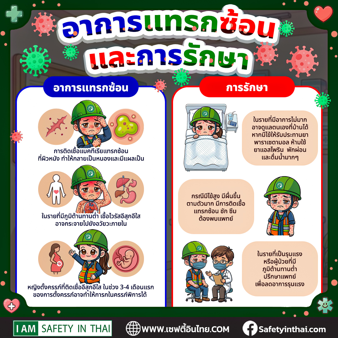 อาการของโรคอีสุกอีใส